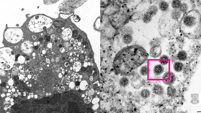 Reino Unido confirma primeira morte do planeta por variante ômicron da Covid-19