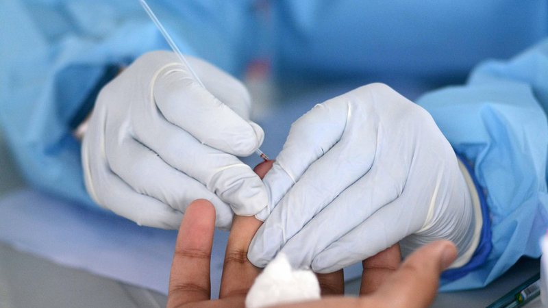 Bahia atinge 23.985 casos ativos de Covid; 18 óbitos registrados em 24 horas￼