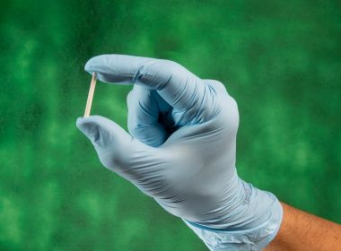 Cada vez mais procurados, implantes hormonais podem causar efeitos colaterais