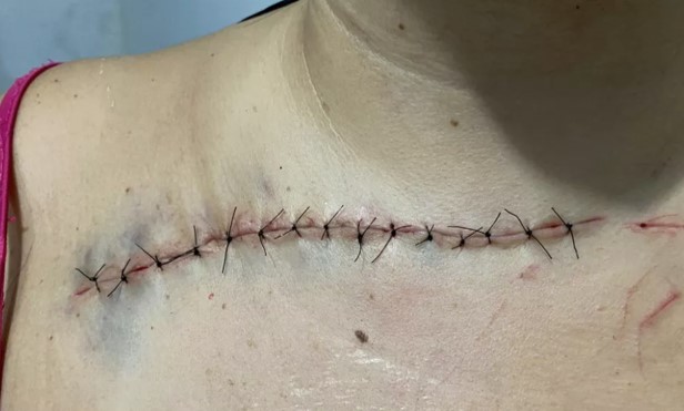 Adolescente tenta matar a própria mãe em Salvador