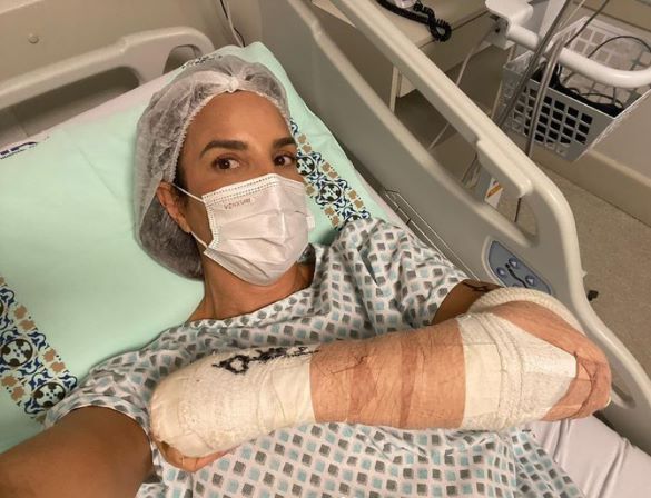 Ivete Sangalo passa por cirurgia no braço e agradece a equipe médica: ‘Mainha ta zero bala!’