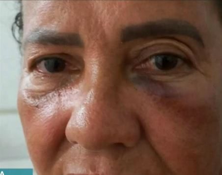 Mulher e sobrinha relatam terem sido espancadas por seguranças de shopping em Salvador