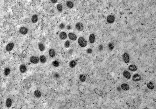 Casos de mpox no Brasil este ano já superam o total de 2023