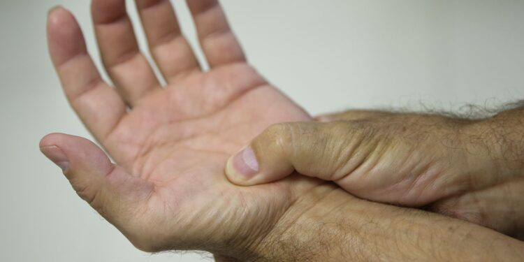 Fibromialgia é reconhecida como deficiência em todo o Brasil.
