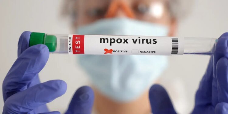 Mpox: Quase 50 mil casos confirmados na África