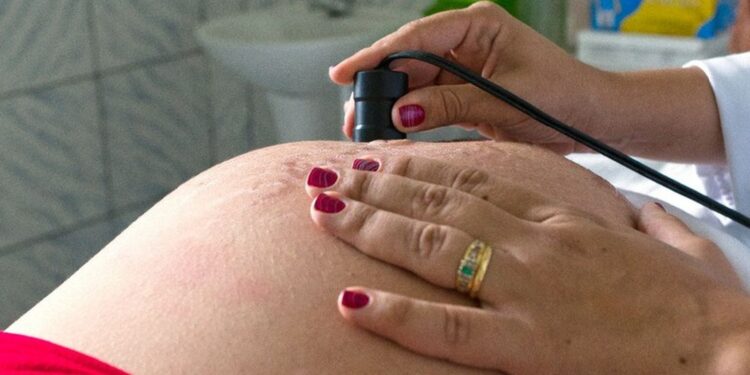 Pré-natal em alerta: avanços no parto não compensam