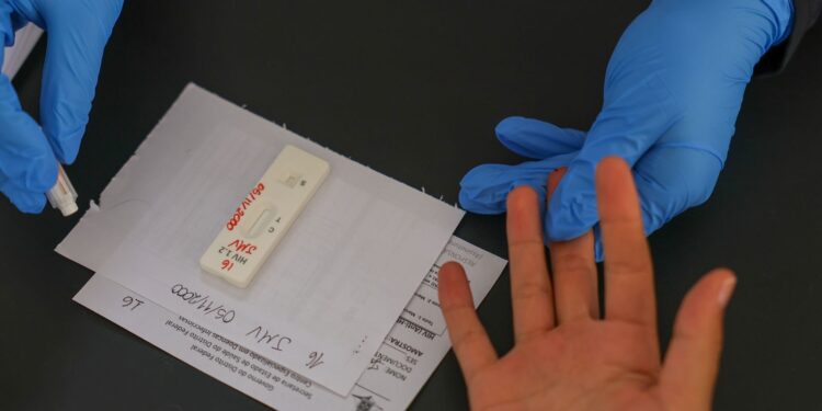 Brasil busca acordo para PrEP de longa duração contra HIV/Aids