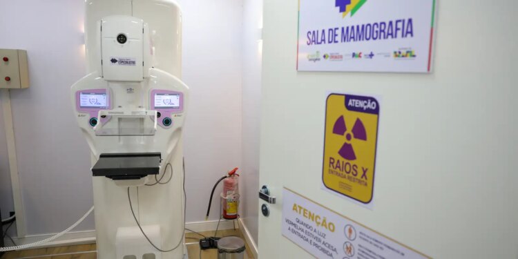 Mamografia no SUS: Cobertura ampliada para mulheres a partir dos 40 anos
