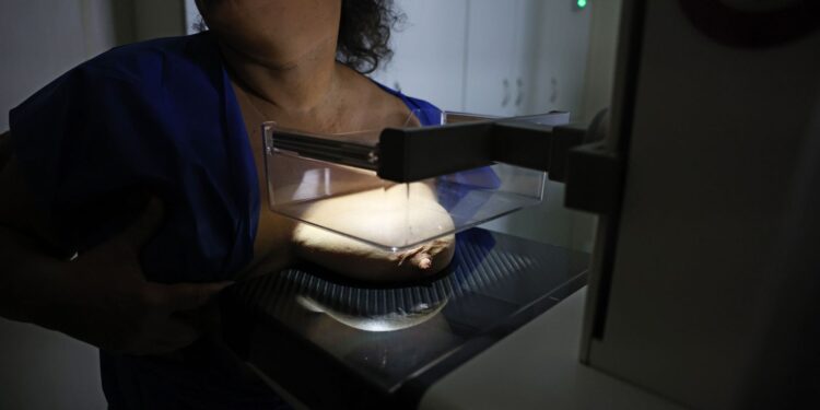 Mamografia alcança 92% de brasileiras entre 50 e 69 anos