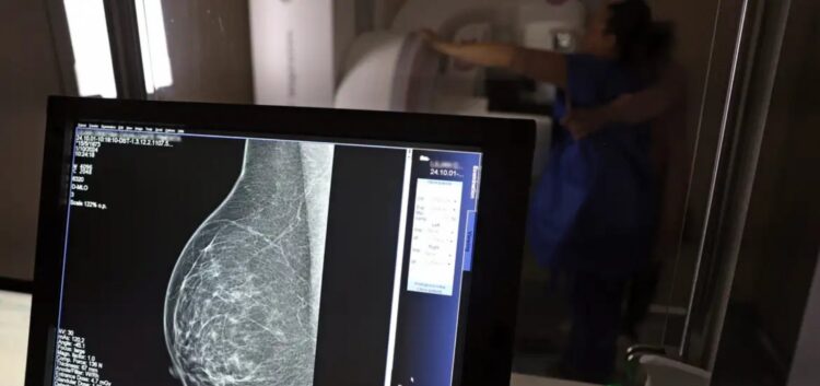 SUS vai oferecer teste genético para detectar risco de câncer de mama hereditário