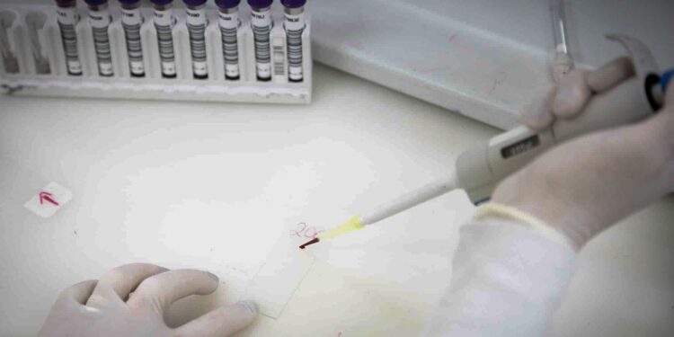 Exames descartam ebola em imigrante da República Democrática do Congo.