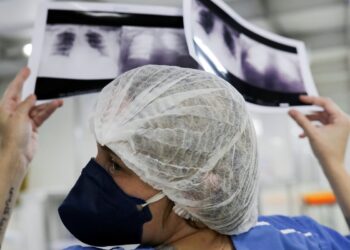 Câncer de pulmão: Diagnóstico tardio reduz chances de cura a mínimas