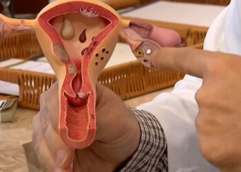 Aberta chamada pública para pesquisas sobre a endometriose