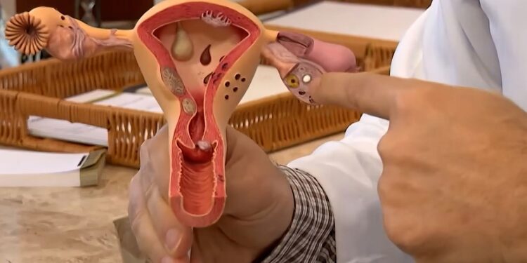 Aberta chamada pública para pesquisas sobre a endometriose