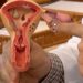 Aberta chamada pública para pesquisas sobre a endometriose