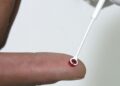 Fiji declara emergência nacional por HIV com 1 caso a cada 60 pessoas